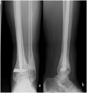 Fig. 5