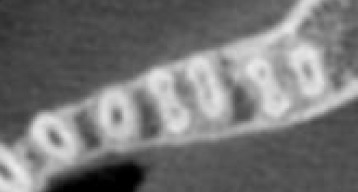 Parte ampliada de uma imagem 2D da mandíbula a partir de uma tomografia ...