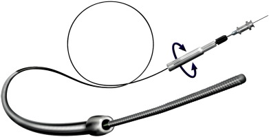 CrossBoss dissection system (Boston Scientific) [51].