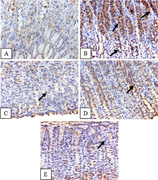 Effect of vanillin on ethanol induced changes in the activation of NF-κB in ...