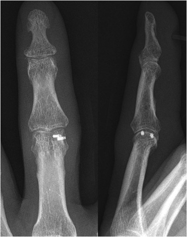 Fig. 4