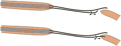 Seesaw wiring technique.
