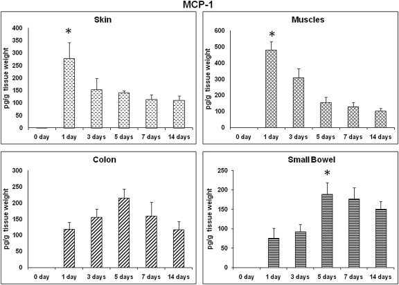 MCP-1: time course of expression. MCP-1 profile in different wound sites over ...
