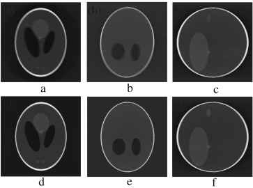 (a–c) Axial, coronal and sagittal slices of the gradual pitch motion corrupted ...