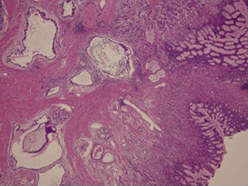 Laparoscopic gastric whole layer biopsy (hematoxylin and eosin, ×100). ...