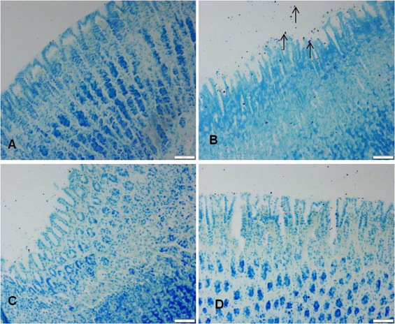 Effect of vanilllin on ethanol induced changes on mast cell distribution in the ...
