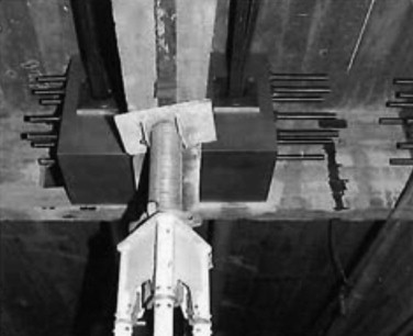Structural consolidation of the reinforced concrete.