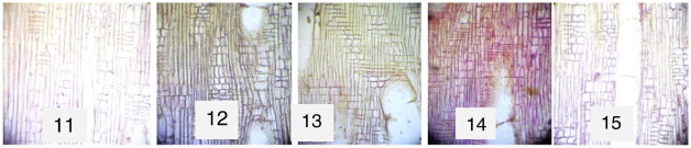 Radial longitudinal sections (×100). 11: Xylene-cleared. 12: Groundnut ...