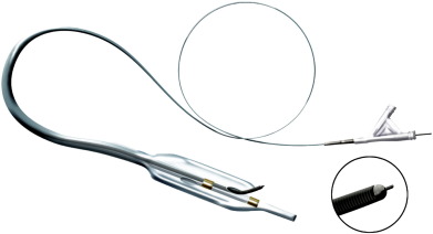 The Stingray reentry system (Boston Scientific) [51].