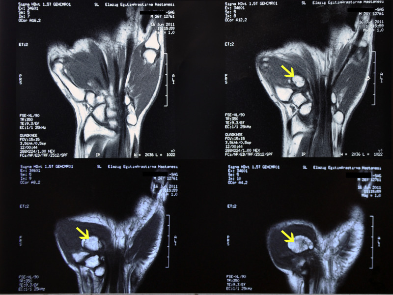 Fig. 1