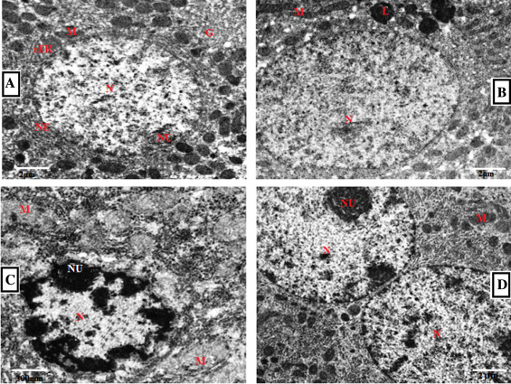 Electron micrographs of liver in control and experimental rats. (A) Control ...