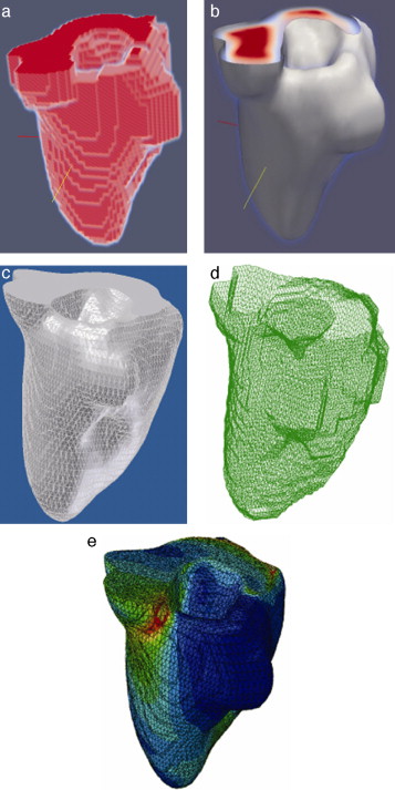 Vista tridimensional de ventrículo izquierdo. (a) Volumen original visualizado ...