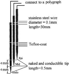 Diagram of monophasic action potential recording electrodes. The distal, middle ...