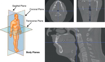 Imágenes médicas de las vías respiratorias.