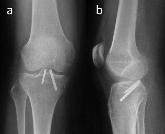 Fig. 4