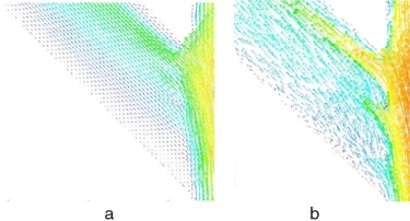 Vectores velocidad en el plano medio en una bifurcación a 45° sometida a la ...