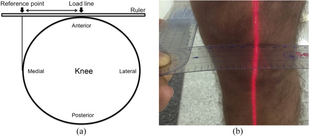 Diagram (a) of the knee joint in transverse plane shows placement of the ruler ...