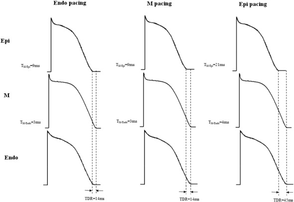 Effect of endocardial, mid-myocardial, and epicardial pacing on transmural ...