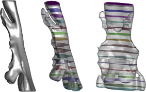Geometría del dominio de análisis sin aparato bucal. Vistas de los cortes ...