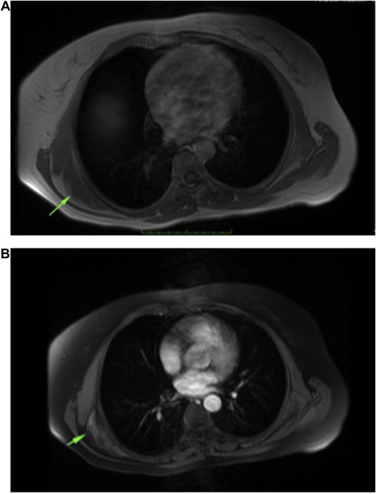 Fig. 5