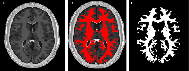 Materia blanca segmentada en volumen phantom. (a) Corte axial número 98 de la ...