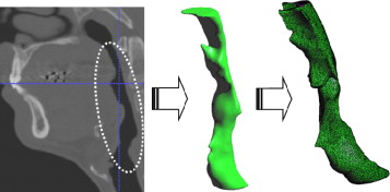 Imagen médica, volumen de los conductos digitalizado y modelo numérico.