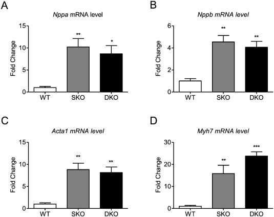 Expression of markers of the hypertrophic gene program.mRNA levels of A, Nppa, ...
