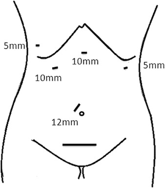 Port positions.