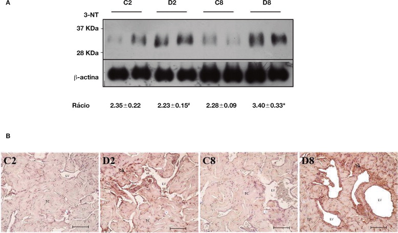 Quantificação da expressão da 3‐NT por western blotting (A) e avaliação do seu ...