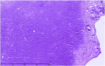 CAT microscopic image (personal unpublished data).Microscopic findings showing ...