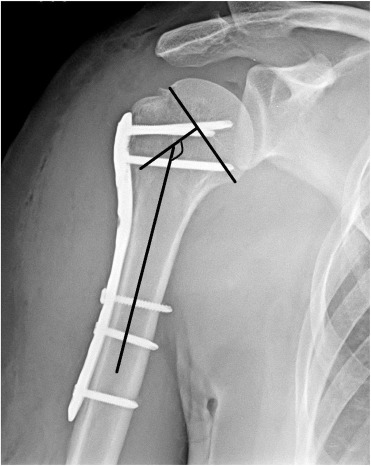 Fig. 3
