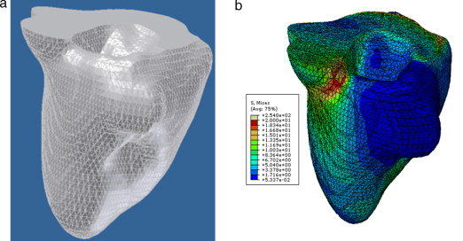 Generación de malla y análisis con FEM de prueba del ventrículo izquierdo. (a) ...