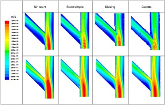 Contornos de velocidad obtenidos experimentalmente con PIV (imágenes superiores) ...