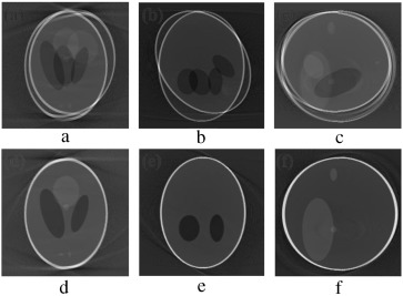 (a–c) Axial, coronal and sagittal slices of combined rotational and ...