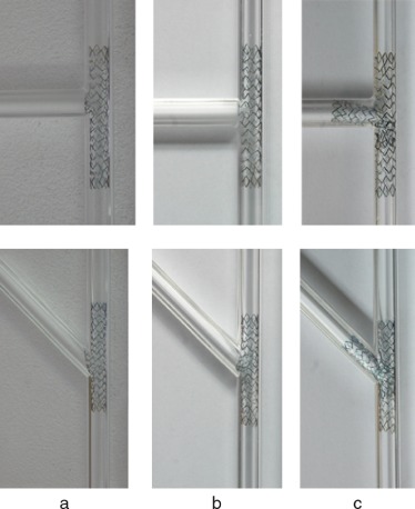 Técnicas de implante de stent en la bifurcación coronaria contempladas en este ...