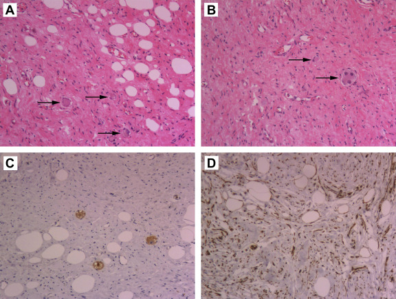 Histological findings (hematoxylin and eosin staining, A and B) and ...