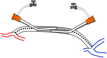 Drawing the ineffective zone when two sheaths are inserted deeply and ...