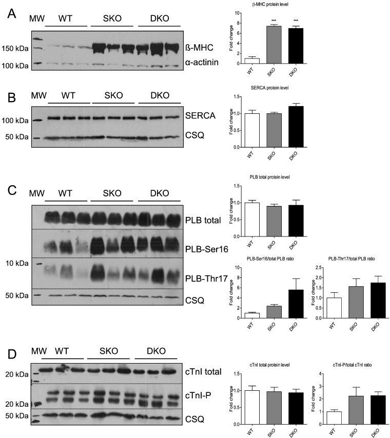 Analysis of calcium-handling proteins in WT, SKO and DKO mice.Representative ...