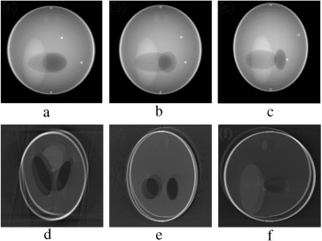 (a–c) Projection at 160°, 180° and 200° source position. (d–f) Axial, coronal ...