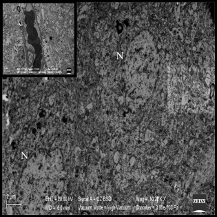 Reversibility of precapillary astrocytic edema and neuronal injury after ...