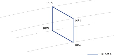 Modelización de los diafragmas intermedios.