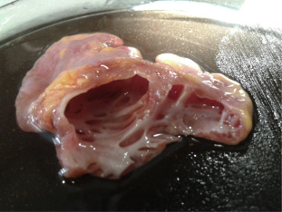 Right auricle.