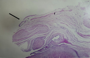 Fig. 4