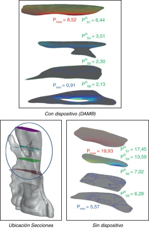 Presiones máximas y mínimas y presión de referencia (Pa) en 4 secciones del ...