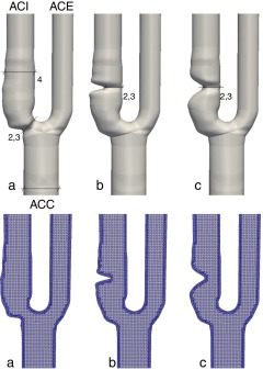 Carótidas idealizadas. Arriba: modelos con dimensiones en milímetros. Abajo: ...