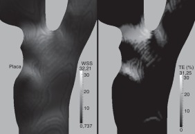 Caso clínico. Izquierda: WSS medio en un ciclo cardíaco, WSS¯ en Pa. Derecha: TE ...
