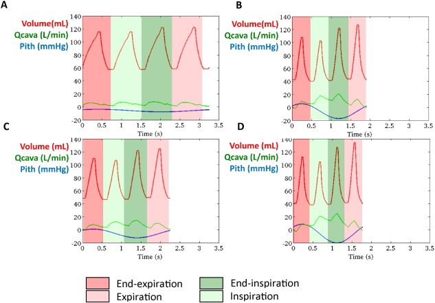 A representative example of simulated stroke volume and caval vein flow at rest ...