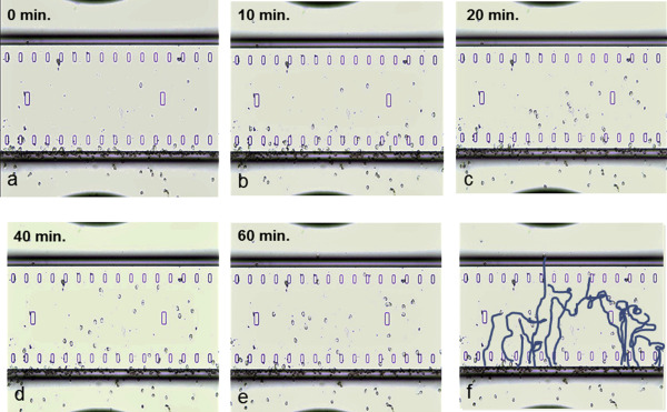 Chemotaxis of human eosinophils from normal donor blood toward a concentration ...