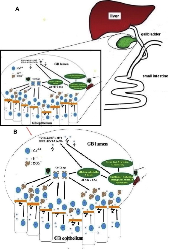 Schematic diagrams of hypothetical model for the pathogenesis of calcium ...