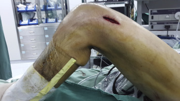 ROM before pie-crusting.